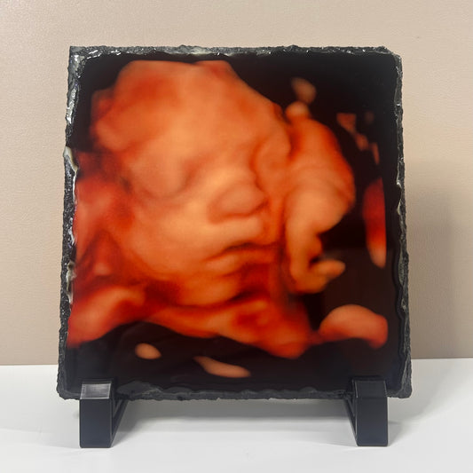 Baby Scan Photo Slate 15cm Square